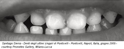 Santiago Sierra - Denti degli ultimi zingari di Ponticelli - Ponticelli, Napoli, Italia, giugno 2008 - courtesy Prometeo Gallery, Milano-Lucca