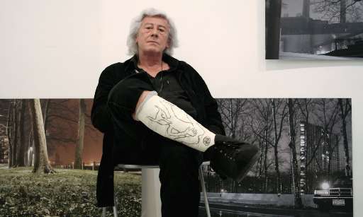 Vi siete rotti un osso? Diventa subito arte