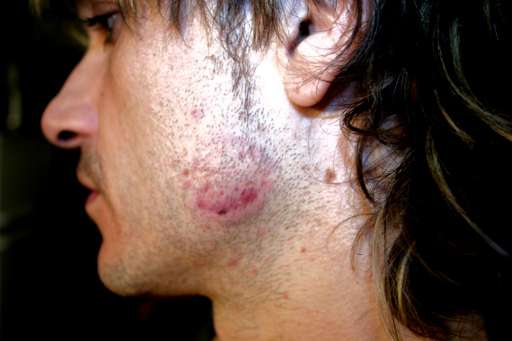 Da Torino, durante i party? Gli artisti si pigliano a mozzichi