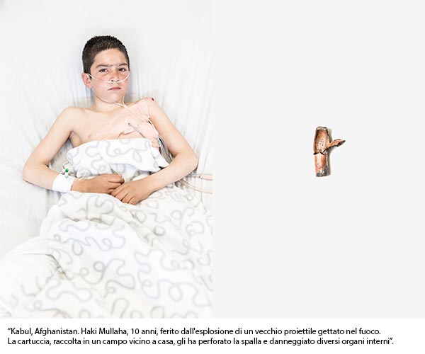 Zakhem|Ferite|Wounds. La guerra a casa|When war comes home di Giulio Piscitelli | a CASA EMERGENCY Zakhem|Ferite|Wounds. La guerra a casa|When war comes home di Giulio Piscitelli | a CASA EMERGENCY