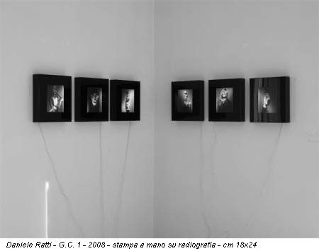 Daniele Ratti - G.C. 1 - 2008 - stampa a mano su radiografia - cm 18x24