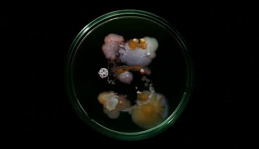 Batteri metropolitani