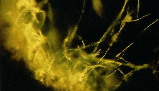 Un cactus perenne per Siedlecki