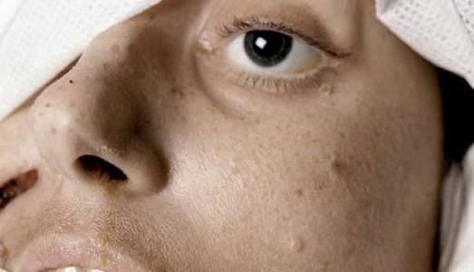 Il diritto della scelta