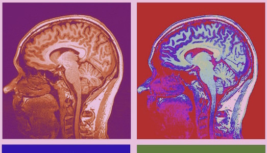 Gli effetti dell’arte