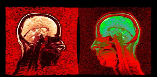 A Roma, le immagini di Fabrizio Borelli, tra diagnostica e grafica