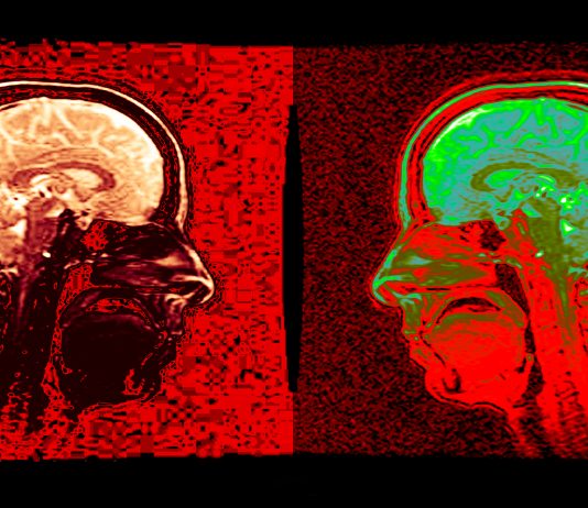 A Roma, le immagini di Fabrizio Borelli, tra diagnostica e grafica