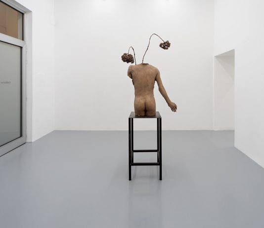 Hormone Disruptors: i corpi di Luca Francesconi in mostra a Napoli