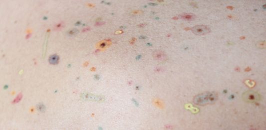 Mind The Gap: a Gorizia, il progetto d’arte contemporanea ispirato a Franco Basaglia