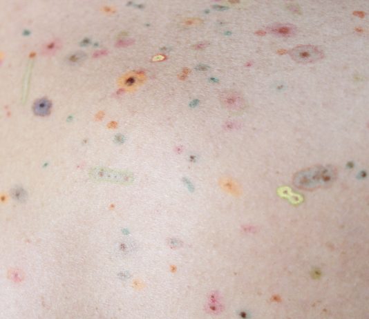 Mind The Gap: a Gorizia, il progetto d’arte contemporanea ispirato a Franco Basaglia