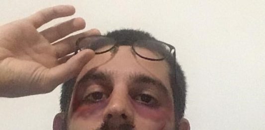 It’s a Mad, Mad, Mad, Mad World #25. Intervista a Matteo De Nando