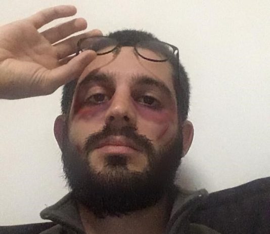 It’s a Mad, Mad, Mad, Mad World #25. Intervista a Matteo De Nando