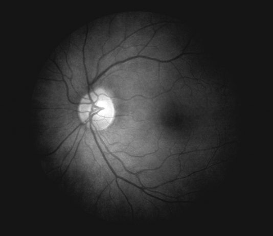 Fotografie contaminate dall’interiorità: Dimitra Dede alla Spot Home Gallery