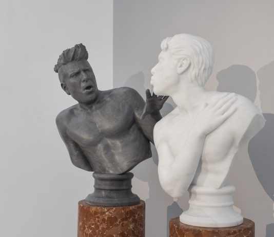 Vezzoli e Fedez, rimandata l’asta benefica a sostegno di TOG fedez vezzoli asta