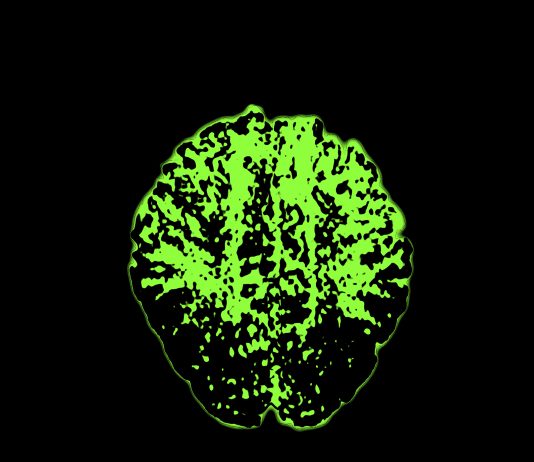 Arte, gamification e NFT: l’esperienza multiplayer di Contagion