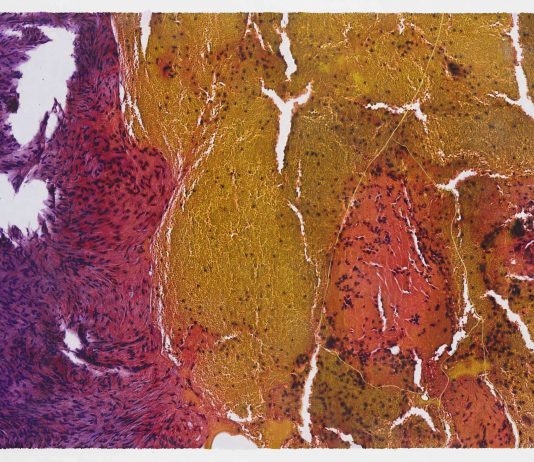 Milano, i corpi in attesa di Aldo Salucci in mostra da A.MORE Gallery