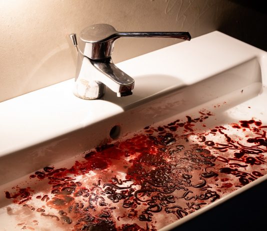 Oltre il sangue amaro: una mostra collettiva sul dolore, al MOCA di Brescia