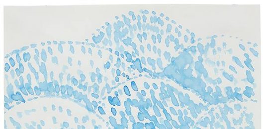 LOUISE BOURGEOIS Rare Language dal 25 giugno al 31 ottobre 2024 allo Studio Trisorio di Napoli