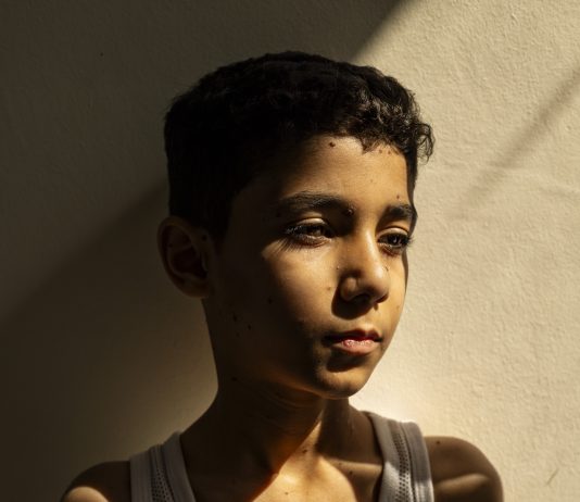 World Press Photo 2025: l’infanzia mutilata è l’immagine dell’anno