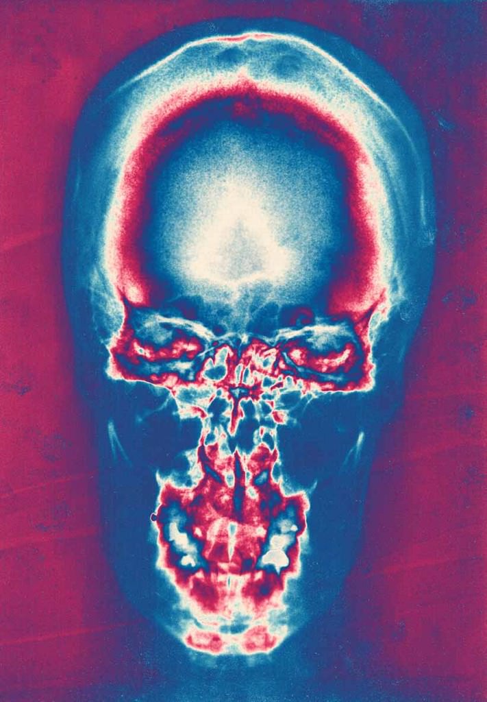 Massimo Drago – X-Rayshttps://www.exibart.com/repository/media/eventi/2003/10/massimo-drago-8211-x-rays.jpg