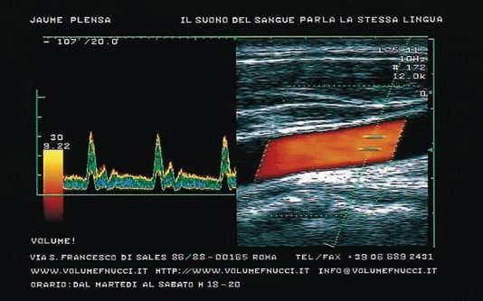 Jaume Plensa – Il suono del sangue parla la stessa lingua