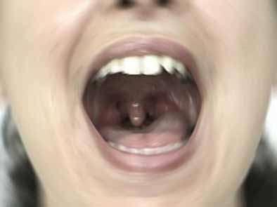 Graffi sotto le stelle Graffi sotto le stelle