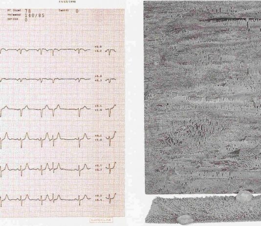 Alessio Larocchi – prestami il tuo cuore all’Hopital Bellevue