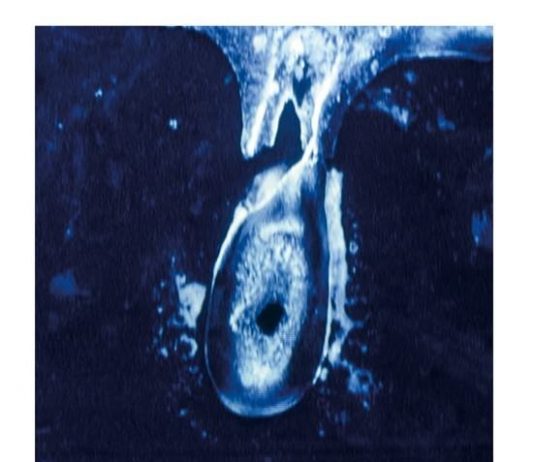 Anneé Olofsson – willyoustilllovemetomorrow