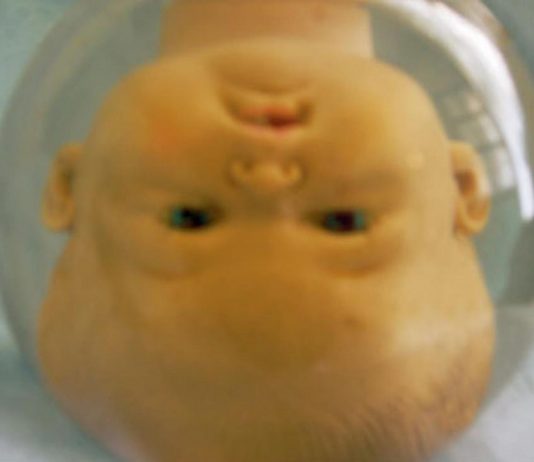 Myriam Laplante – Elisir Myriam Laplante – Elisir