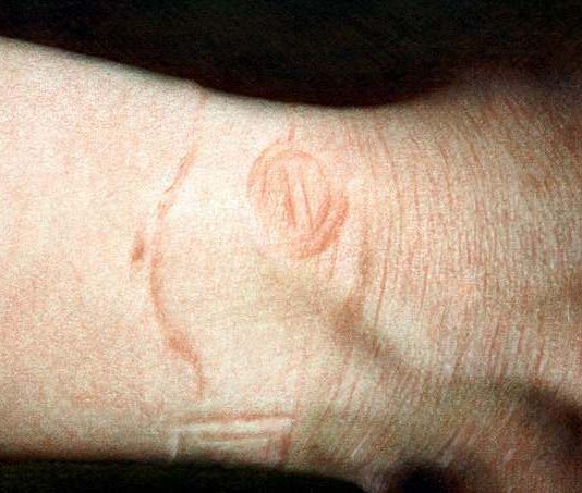 Vania Comoretti – Skin