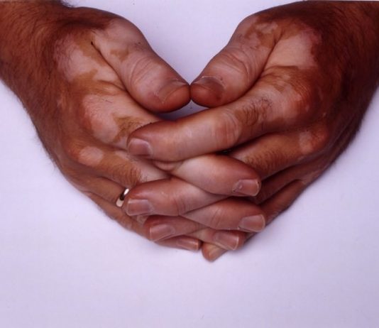 Nedko Solakov – A Group Show