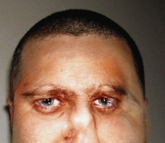 Pino Grisanti – Corpi e derivati