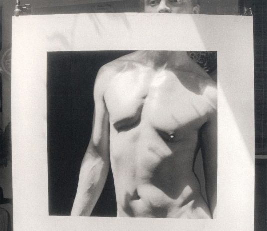 Rolf Koppel – “Verklärte Nacht” ossia Notte chiaro scura