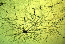 Golgi, architetto del cervello Golgi, architetto del cervello