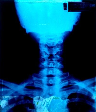 Renato Meneghetti – Eghènetai! Buio, non “ombra”. Luce