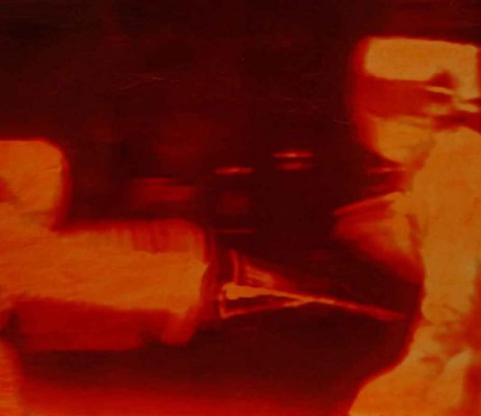 Luigi Grandillo – Colpo al cuore Luigi Grandillo – Colpo al cuore