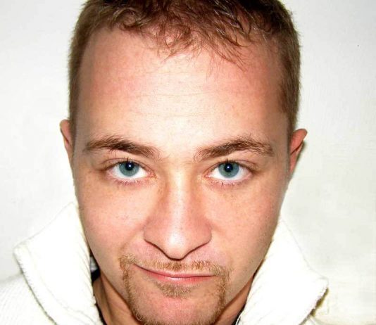 Daniele Montenovo – Alterazioni visive