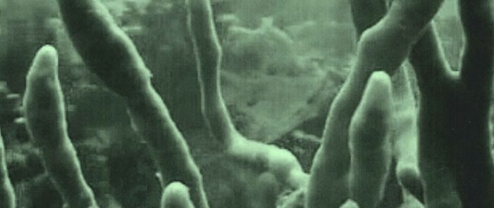 Francesco Cavaliere / Leila Hassan – SEA URCHINhttps://www.exibart.com/repository/media/eventi/2011/05/francesco-cavaliere-leila-hassan-8211-sea-urchin.jpg