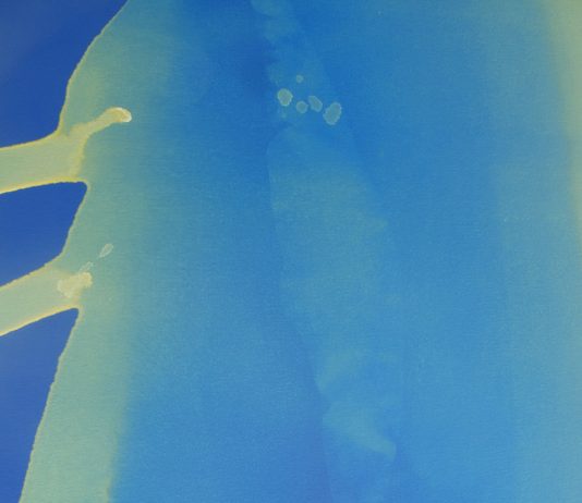 Kasper Sonne – Bad Chemistry