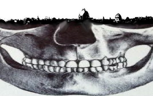 Point of view n2, punti di vista n2