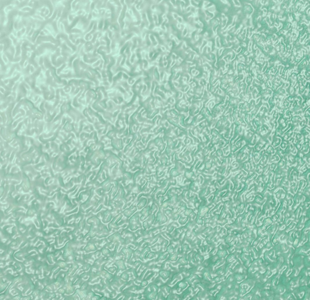 Alessandro Moroni – Garagesublimehttps://www.exibart.com/repository/media/eventi/2016/04/alessandro-moroni-8211-garagesublime-1068x1034.jpg