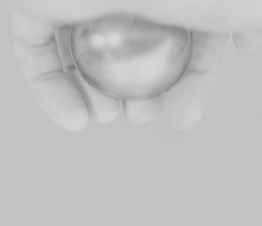 Davide Balula – Iron levels