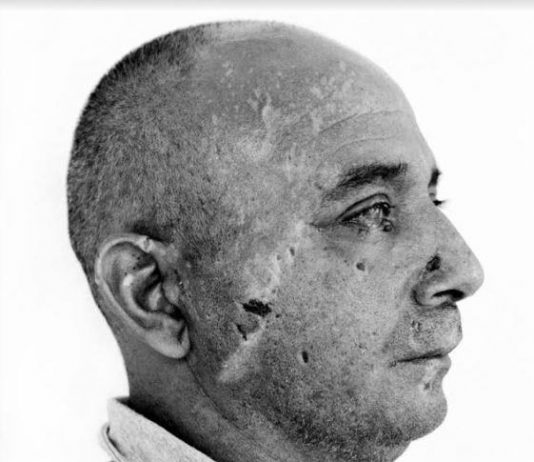 Iraq: una ferita aperta.  Giles Duley per EMERGENCY