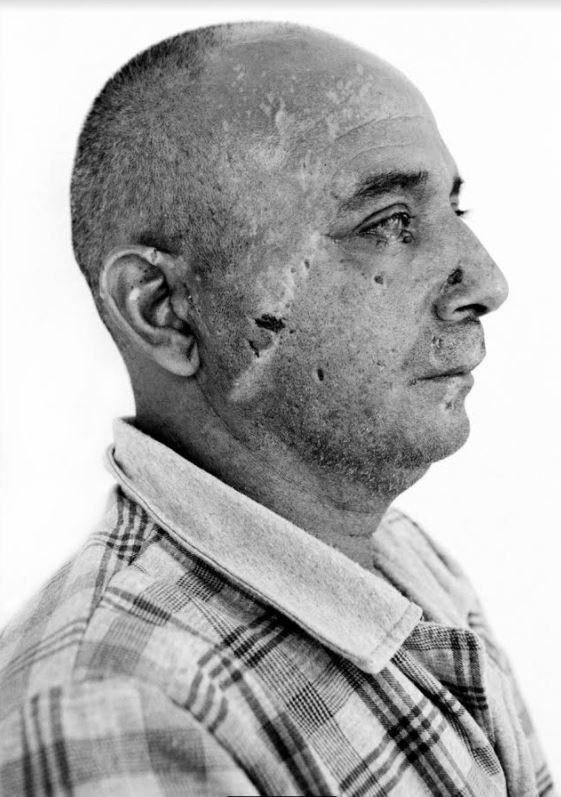 Iraq: una ferita aperta. Giles Duley per EMERGENCYhttps://www.exibart.com/repository/media/eventi/2017/10/iraq-una-ferita-aperta.-giles-duley-per-emergency.jpg