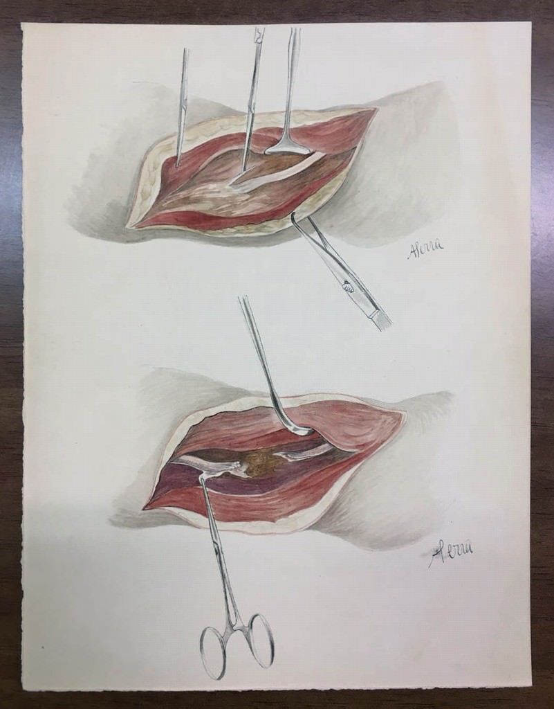 Il Fronte in Corsia. Il Rizzoli nella retrovia della Grande guerrahttps://www.exibart.com/repository/media/eventi/2017/11/il-fronte-in-corsia.-il-rizzoli-nella-retrovia-della-grande-guerra.jpg