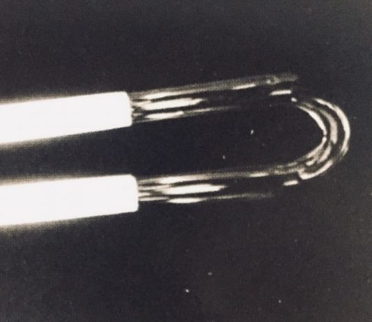 Tobias Hoffknecht – Limited Attention