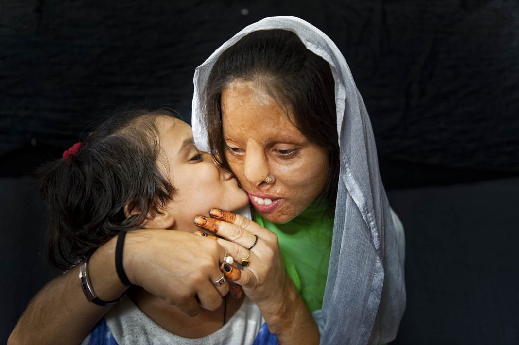 Silvia Alessi – Skin Projecthttps://www.exibart.com/repository/media/eventi/2019/04/silvia-alessi-8211-skin-project-3-1068x711.jpg