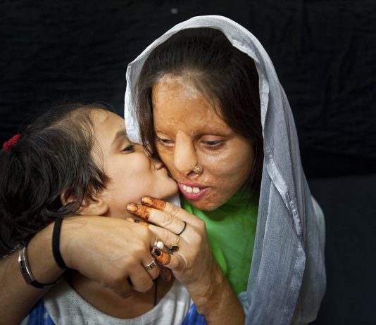 Silvia Alessi – Skin Project