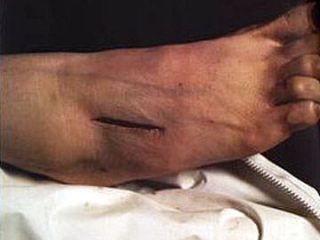 andres serrano_the morgue
