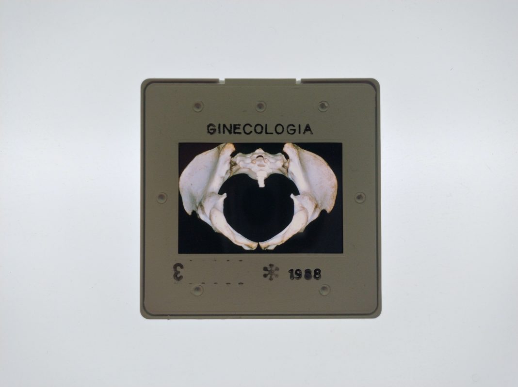 Cesare Pietroiusti – Materia paternahttps://www.exibart.com/repository/media/formidable/11/img/134/immagine-comuicazione-Materia-Paterna-1068x799.jpg